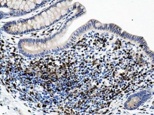 MarmAbcam-CD31in50